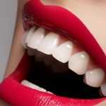 Знищать гарну посмішку: Названо продукти, шкодять здоров’ю зубів